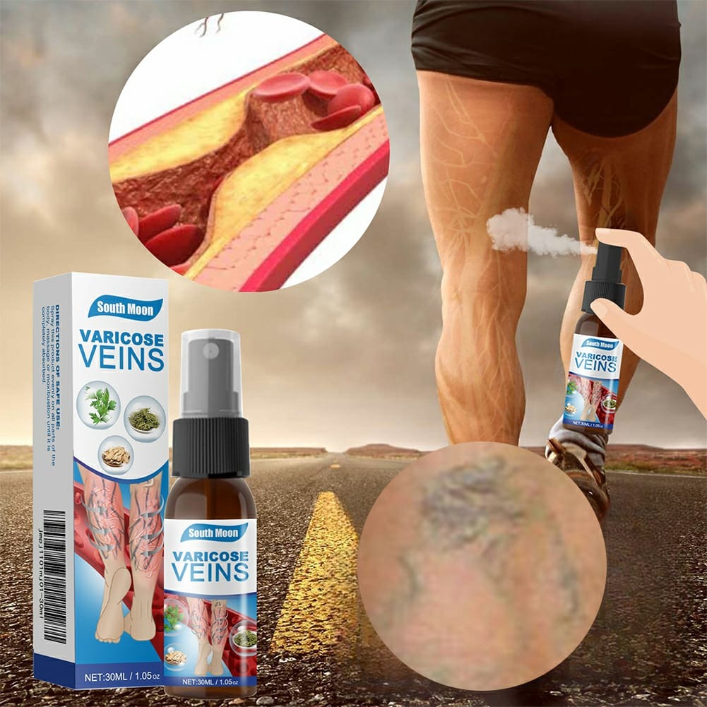 South Moon Varicose Veins Treatment Spray – 30ml Advanced Formula for Spider Veins, Leg Pain & Swelling Relief | Natural Herbal Spray for Better Circulation - Image 4