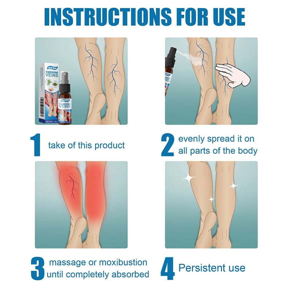 South Moon Varicose Veins Treatment Spray – 30ml Advanced Formula for Spider Veins, Leg Pain & Swelling Relief | Natural Herbal Spray for Better Circulation - Image 5